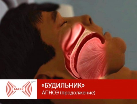 Будильник. АПНОЭ (продолжение)