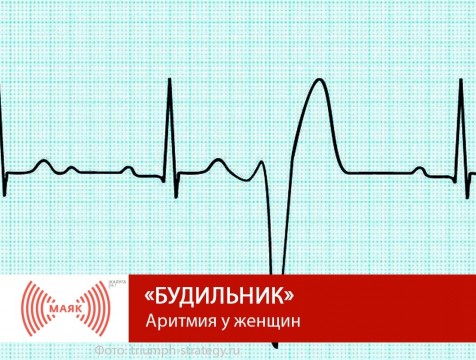 Будильник. Аритмия у женщин