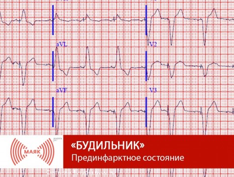 Будильник. Прединфарктное состояние