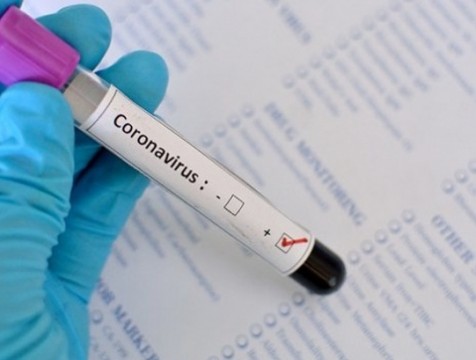 Число умерших от COVID-19 возросло до 5 человек