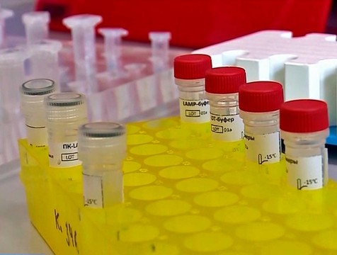 Тестирование на антитела к коронавирусу начинается в регионе
