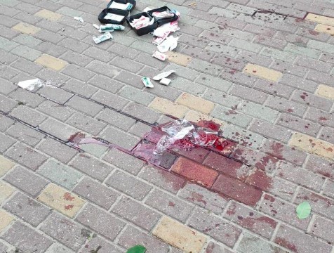 Калужанин нанес удар ножом в шею бывшей супруге
