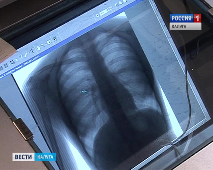 Флюорография1026.jpg